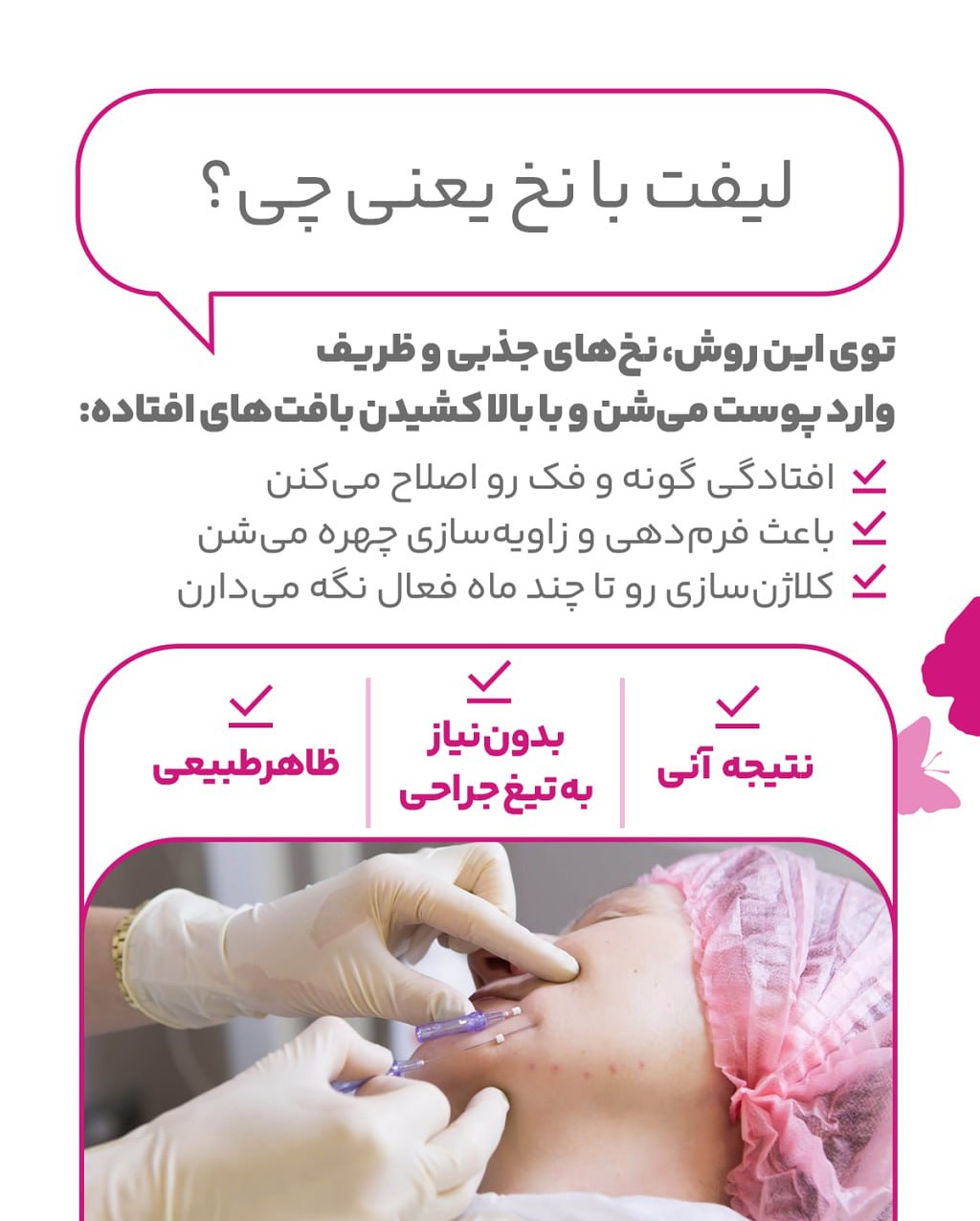 لیفت صورت با نخ چیست؟